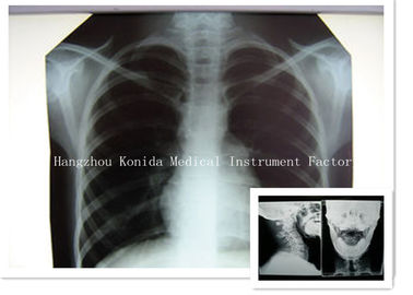 Suchy film cyfrowy medyczny X Ray 14 x 17 cali Obrazowanie zdrowotne Film radiograficzny