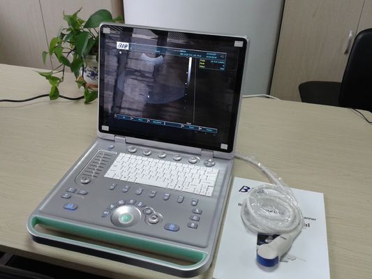 Laptop 3D Cyfrowy Przenośny ultrasonograf z wszelkiego rodzaju sondy